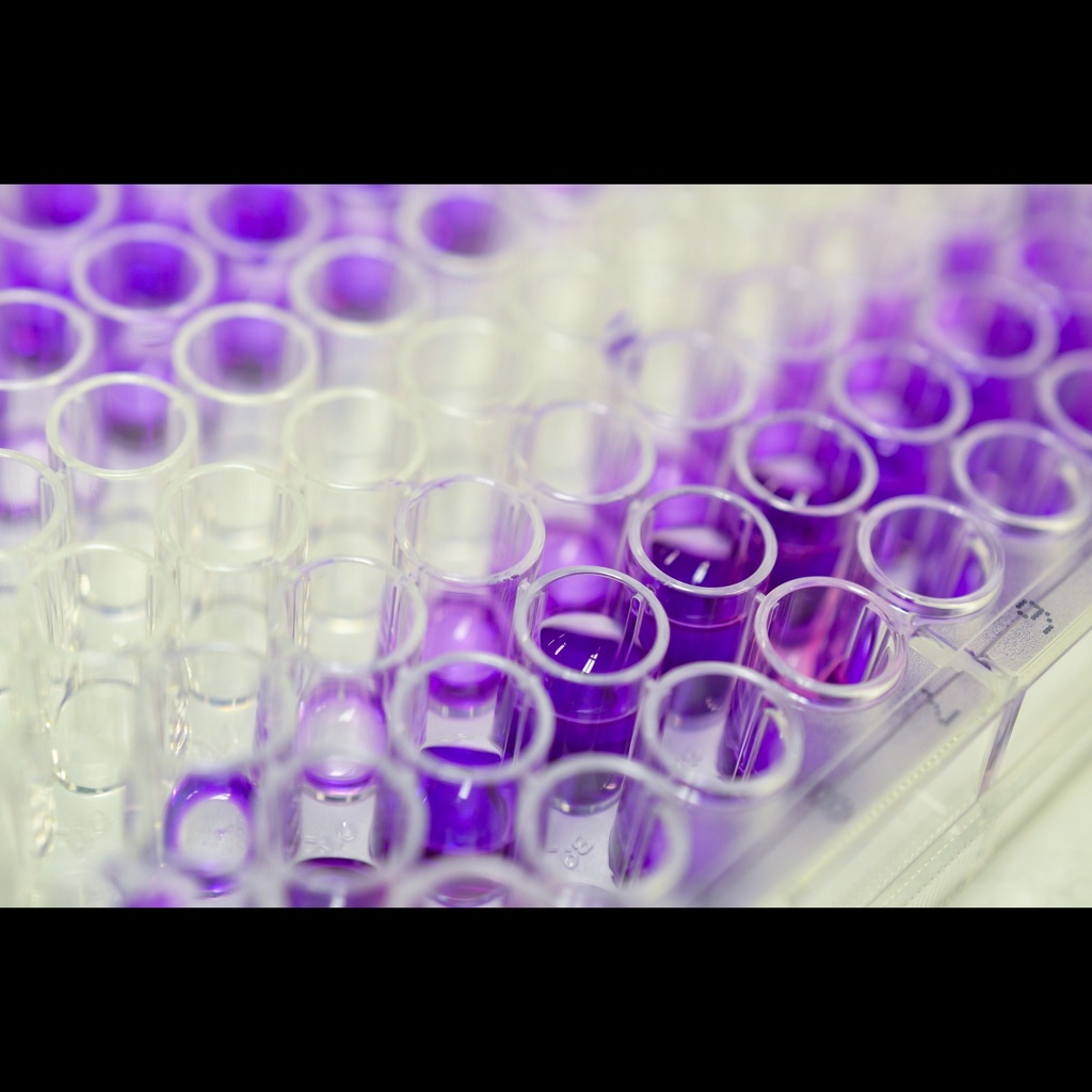 Human Botulinum toxin A（ BTXsize:A）ELISA Kit size: 96 Tests